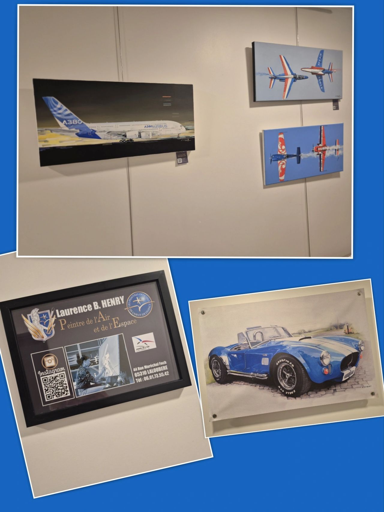 ART